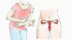 毕节妇女打胎后肚子痛是怎么回事