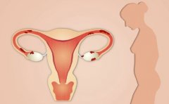 毕节妇女堕胎都需要注意什么